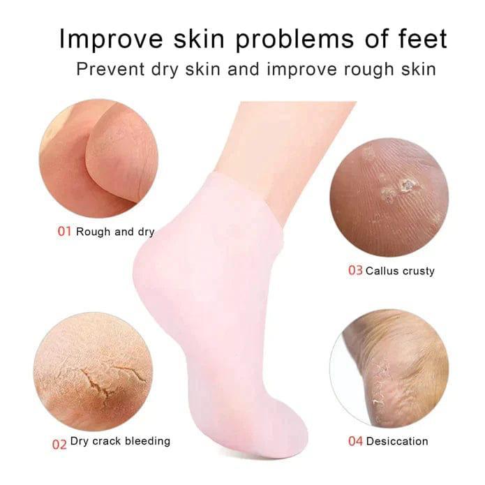 Silicone gel socks