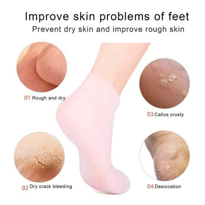 Silicone gel socks